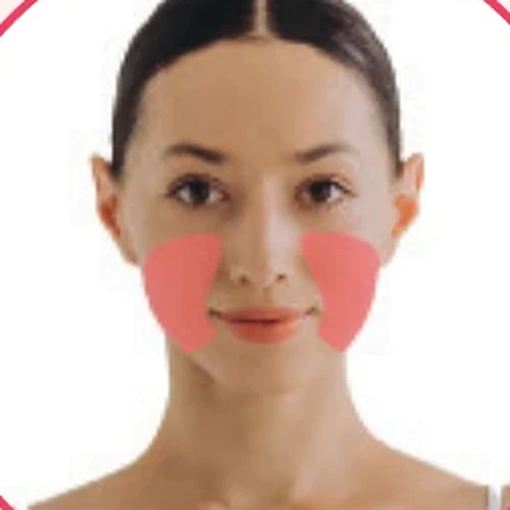 Demarcação da área feminina: Faces laterais.
